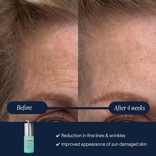 ELEMIS Pro-Collagen Renewal Serum - Gentle Retinol Alternative for Smoother Skin | 15ml