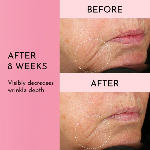 Lawless Mini Forget the Filler Skin-Plumping Line-Smoothing Perfecting Cream - Premium Non-Acne Moisturizer Designed to Prime, Plump, Smooth, and Tighten Skin for a Youthful, Hydrating Look - 0.5 oz