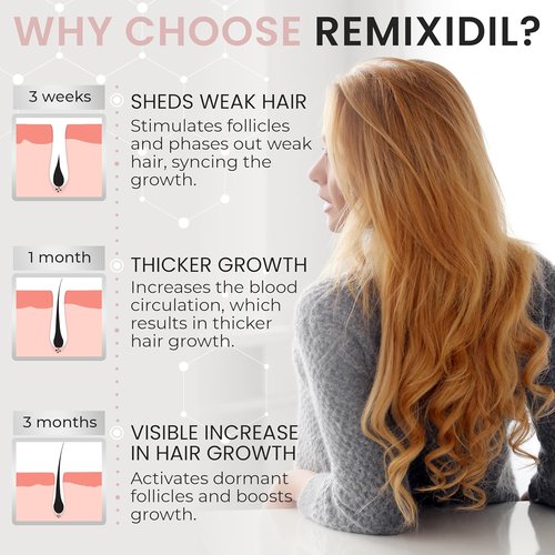 Regine Switzerland 2% Minoxidil Hair Regrowth Spray - Clinically Proven Solution for Thicker, Fuller Hair - 60 ml