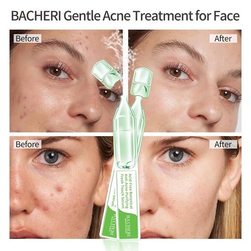 Regine Switzerland Gentle Botanical Acne Treatment - Acid-Free Spot Serum with Niacinamide & Witch Hazel for Sensitive, Oily Skin | 1.2 ml × 30 Ampoules