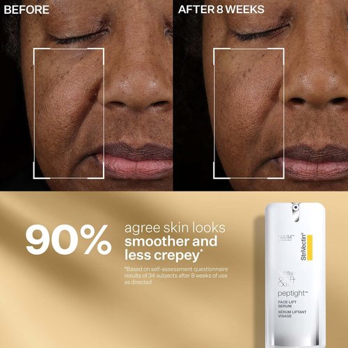 StriVectin Peptight Face Lift Serum - Tightening & Brightening Peptides for Youthful Skin