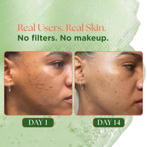Regine Switzerland Matcha Facial Moisturizer - Hydrating Anti-Aging Cream with Rose PDRN & Peptides, 3.53 oz