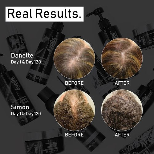 EVOLIS Promote Scalp Activator - Hydrating Scalp Serum for Stronger Hair Growth | 1.7 fl oz