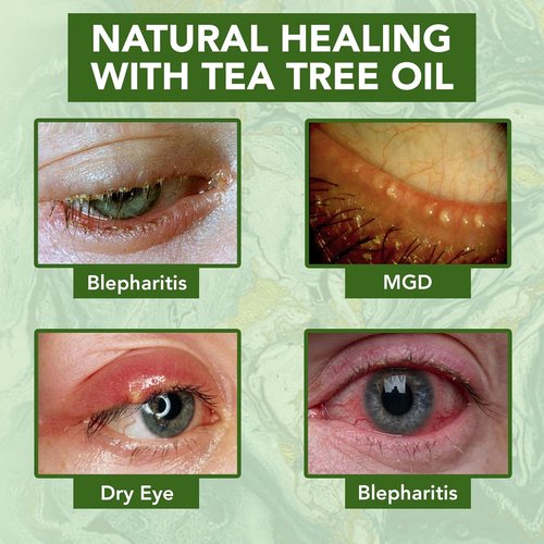 NOVEHA Tea Tree Oil Eye Cream - Anti-Wrinkle Moisturizer for Dry Skin | 1.69 Fl. Oz. Treatment
