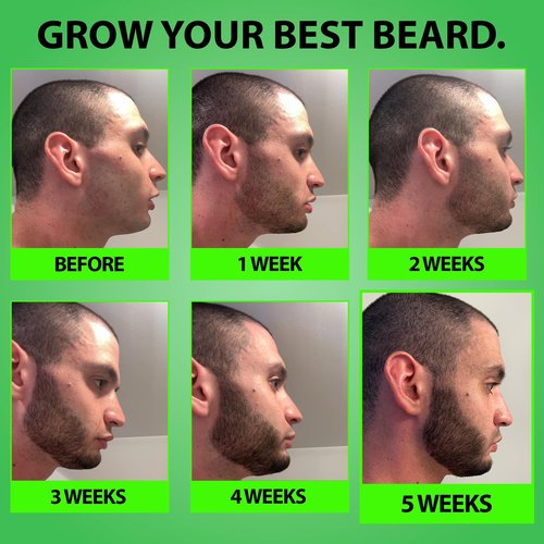 Minoxidil for Beard Growth – 5% Serum with 2X Biotin & Rice Water, Promotes Thicker, Fuller Facial Hair, Ideal for Patchy Areas, Revitalizes Follicles