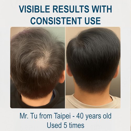 Biochemical Pulse Exosome Hair Growth Serum - Boost Hair Density & Reduce Shedding | 30ml Daily Treatment
