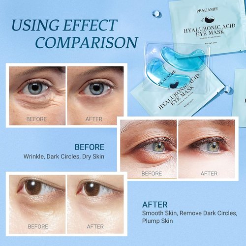 PEAUAMIE Under Eye Patches - Hyaluronic Acid Eye Masks for Dark Circles & Puffiness | 30 Pairs
