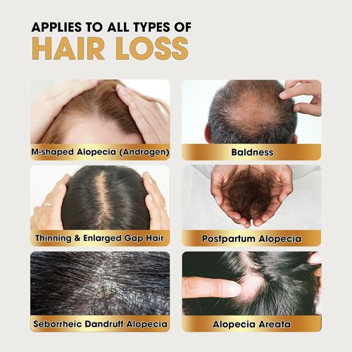 Herb Hair Growth Oil Spray - Strengthen Thinning Hair & Boost Scalp Health for Women & Men