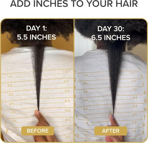 Shedavi Iconic Natural Hair Vitamins - Fast Hair Growth & Thicker Hair | Vegan Supplements (60 Capsules)
