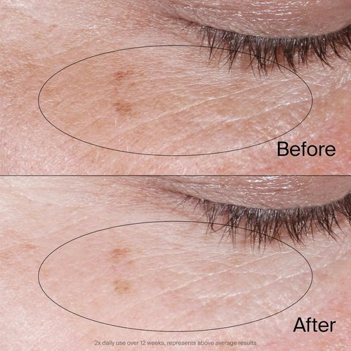 Neutrogena Collagen Bank Eye Cream - Revives Under Eyes, Reduces Dark Circles & Puffiness | 0.5 oz