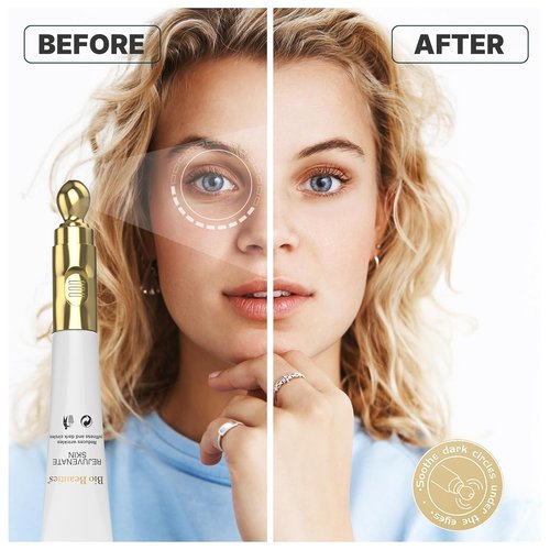 Skiennix Retinol Under Eye Cream - Reduce Dark Circles & Wrinkles | Anti-Aging with Electric Massager