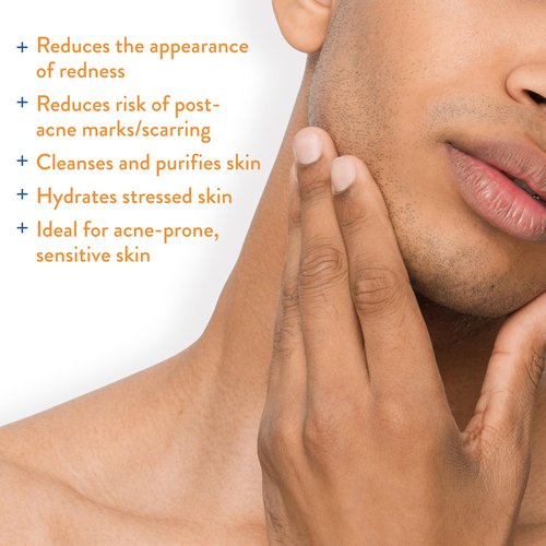 AcneFree Hypochlorous Acid Soothing Spray for Face & Body – Redness Relief Mist for Acne-Prone, Sensitive, or Irritated Skin – Gentle Daily Spray for Breakout Support & Skin Barrier Balance – 4 ounce
