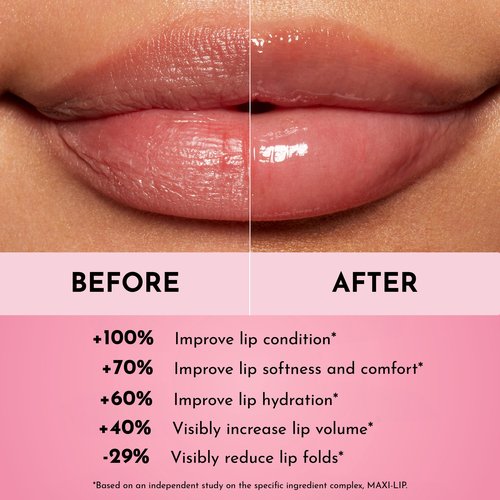 LAWLESS Forget the Filler Lip Mask - Sweet Dreams - Premium Overnight Lip Plumping Treatment with Natural Ingredients Designed to Plump, Hydrate, and Smooth Lips - 0.28 oz