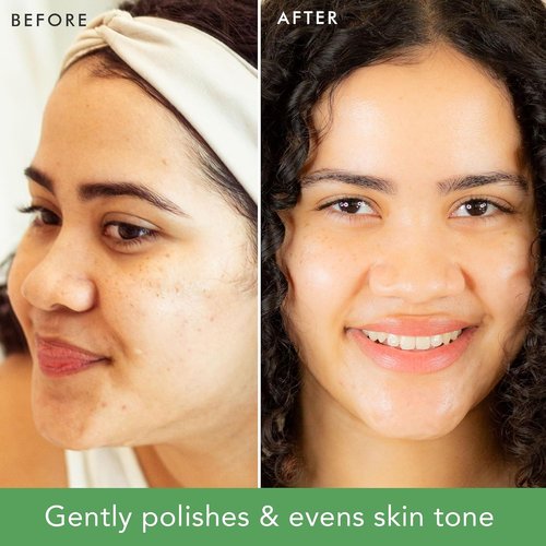 Skiennix Facial Scrub Exfoliator - Gentle Organic Face Wash for Sensitive & Acne-Prone Skin | 2 Fl Oz