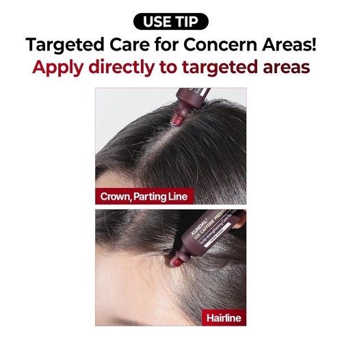 KUNDAL Hair Loss Serum - Caffeine Scalp Tonic & Shampoo for Thicker Hair | White Musk Scent