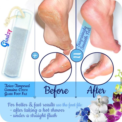 GLADZY Genuine Czech Glass Nail File Set - Callus Remover Foot Rasp, Cuticle Pusher Manicure Stick, Double Sided Etched Different Grit Surface, Professional Nail Care Tool, Made in EU