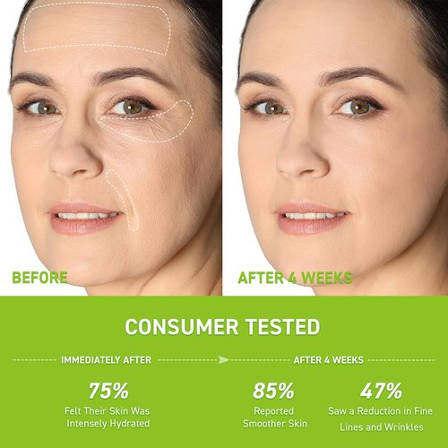 Anti-Wrinkle Retinol Serum for Face: Anti Aging Firming Skin Treatment with Hyaluronic Acid & Collagen - Deep Hydration Facial Care for Women Over 30，Daily & Night Use, 1.0 fl.oz
