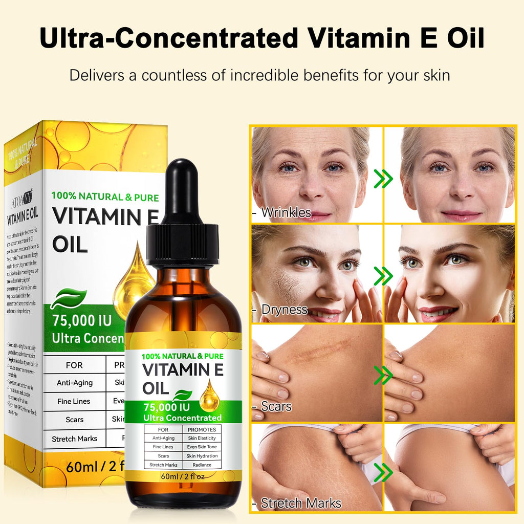 Vitamin E Oil, 75,000 IU, 100% Pure Vitamin E Oil for Skin, Hair & Nails, Hydrating Dry Skin, Face and Body Moisturizer, Reduce Stretch Marks, Wrinkles, 2Fl Oz