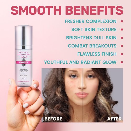 SMOOTH - Glycolic & Lactic Acid Resurfacing Serum - 5% Glycolic + 3% Lactic Acid, Aloe, Witch Hazel, Hyaluronic Acid - Moisturizing & Hydrating Face Serum, Diminish Dryness, Fine Lines & Wrinkles, 1oz