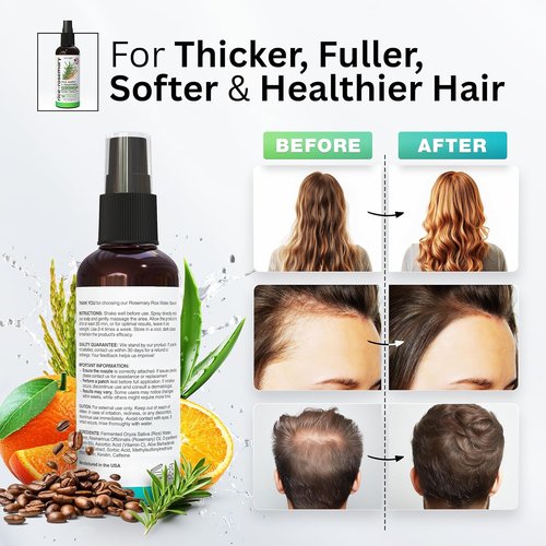 Fermented Rice Water Hair Growth Spray by NEW | Boost Thinning Hair with Rosemary, Biotin & Caffeine - All Hair Types