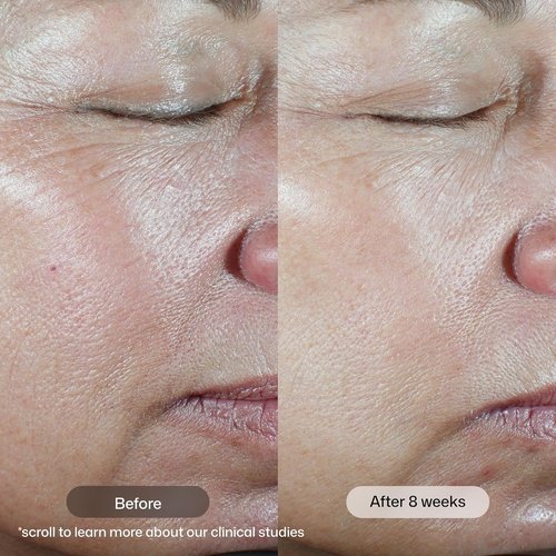 Revision Skincare C+ Correcting Complex 30%® Vitamin C Serum - Brightening Anti-Aging Treatment for Face, Reduces Fine Lines & Dark Spots