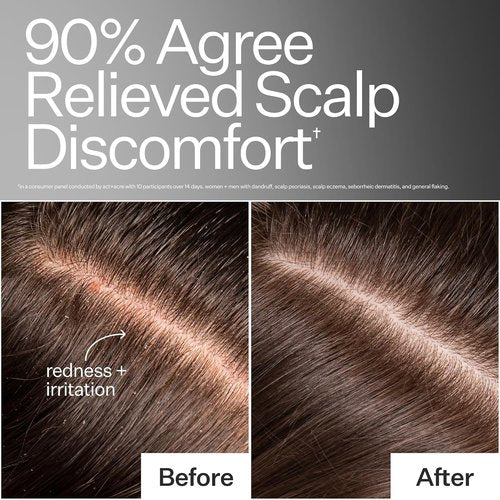 ACT+ ACRE Microbiome Cooling Scalp Serum - Instant Relief for Dry, Itchy Scalp - 2.2 fl oz, Vegan & Paraben-Free