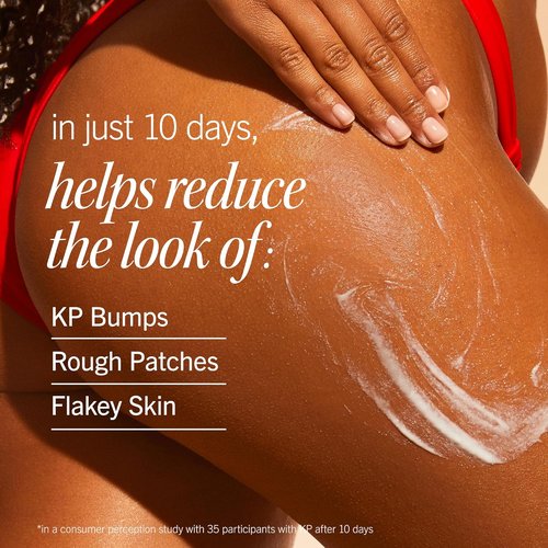 First Aid Beauty - KP Smoothing Body Lotion | 10% AHA & Lactic Acid for Exfoliation & Moisturization - New Peach Scent (6.7 fl oz)