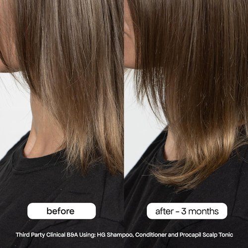 BONDIBOOST Anti-Thinning Hair Conditioner - Hydrating Formula with Aloe Vera & Rosemary | 10.14 fl oz, Sulfate-Free for Thicker, Stronger Hair