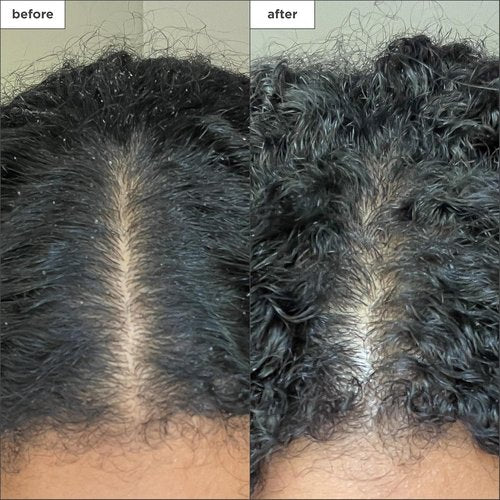 Briogeo Scalp Revival Charcoal + Coconut Oil Shampoo - Detoxifying, Hydrating Scalp Scrub | Sulfate-Free, Vegan