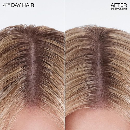 Redken Deep Clean Dry Shampoo - Instantly Refreshes All Hair Types, Absorbs Oil, No Buildup | 5 oz