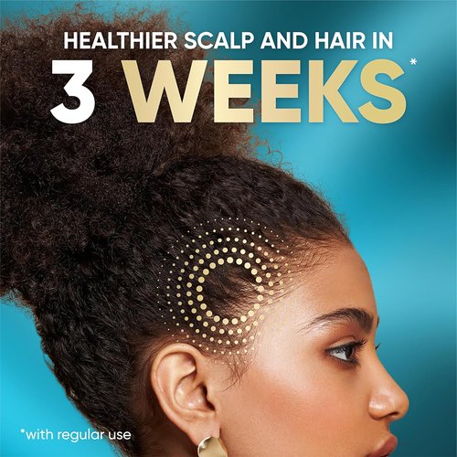 Head & Shoulders Royal Oils Scalp Cream Treatment - Daily Moisture with Coconut Oil, 5 fl oz