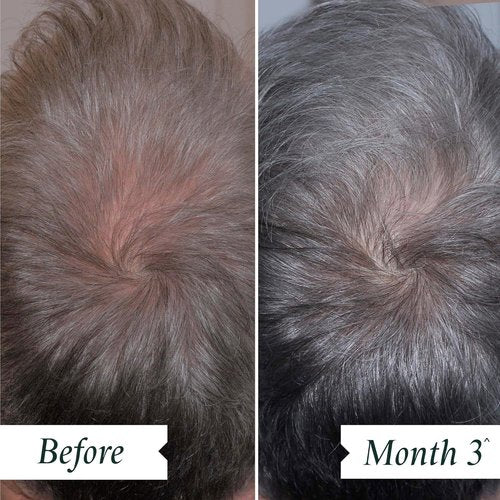 Philip Kingsley Density Preserving Serum - Thinning Hair & Hair Loss Treatment | 2.87 oz