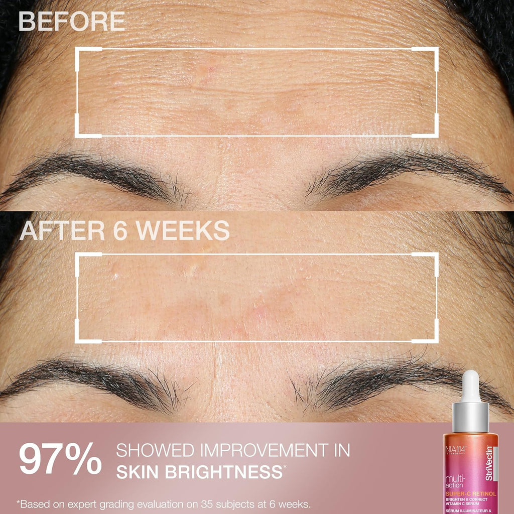 StriVectin Skin Care Holiday Gift Kits - Brightening, Smoothing & Hydrating Beauty Sets for Glowing Skin
