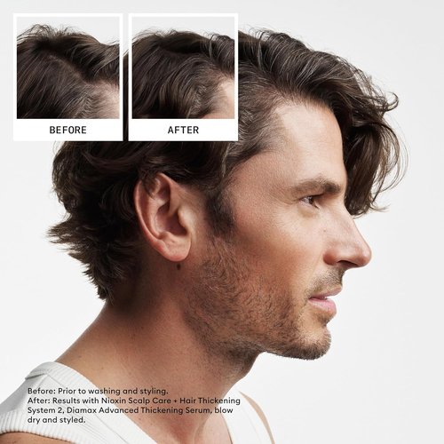 Nioxin System 2 Thickening Shampoo - Boost Hair Density for Natural Hair with Niacinamide & Biotin