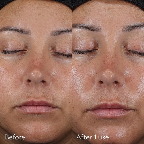 IMAGE Skincare Daily Prevention Ultra Defense Moisturizer - SPF 50 Broad Spectrum Sunscreen | Fragrance-Free