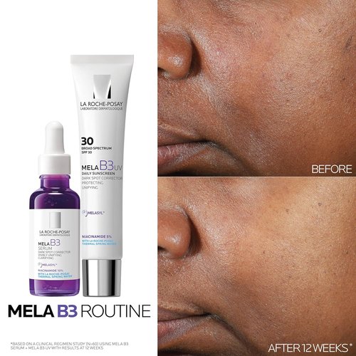 La Roche-Posay Mela B3 Serum - Dark Spot Corrector With 10% Niacinamide | Anti-Aging Formula for Sun & Age Spots