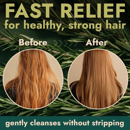 Rosemary Shampoo and Conditioner Set - Tea Tree & Rosemary Oils for Scalp Relief | Sulfate-Free, Soothes Dry Scalp + Free Scalp Brush | 16.9 fl oz