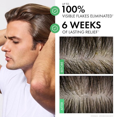 Dercos Dandruff Shampoo - Antifungal Treatment for Itchy Scalp Relief | Prescription Strength Selenium Sulfide