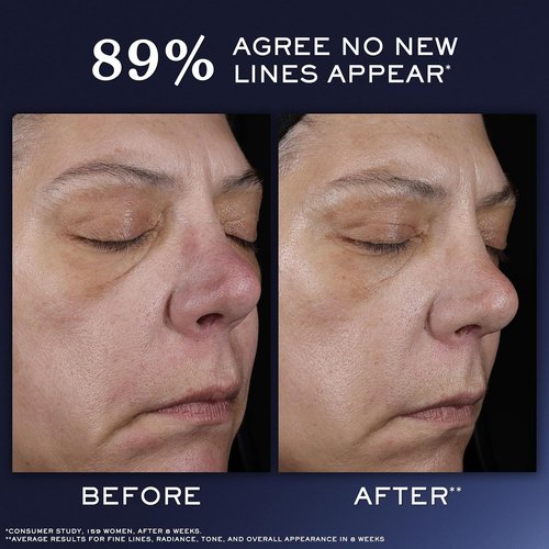 Lancôme Génifique Ultimate Dual Recovery Face Serum - Anti-Aging Formula for Fine Lines & Even Skin Tone - 30ml