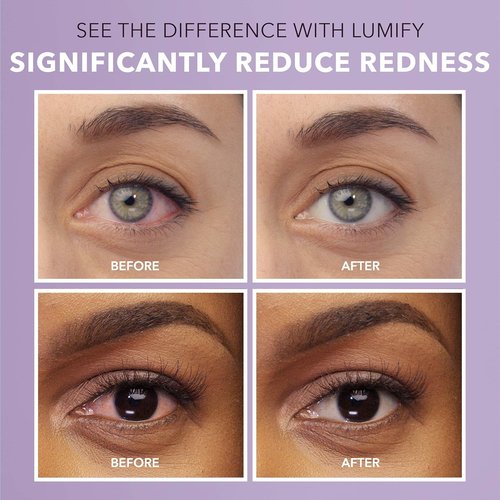 LUMIFY Eye Drops - Redness Reliever for Brighter Eyes | Works in 1 Minute, Lasts 8 Hours, 0.25 Fl Oz