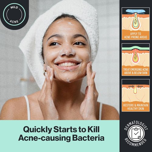 Oxy Acne Cleanser for Sensitive Skin - Gentle Formula for Clearer Complexion | 6 oz