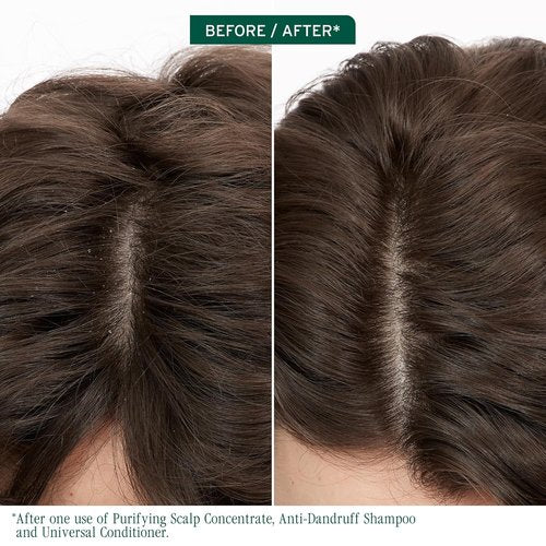Biolage Scalp Sync Anti-Dandruff Shampoo - Moisturizing Treatment for Itchy Scalp, 1.7 FL Oz