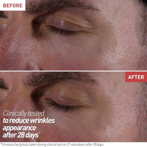 Erborian Skin Therapy Eye Cream - Multi-Perfecting Anti-Aging Formula, Illuminates & De-Puffs, 15mL