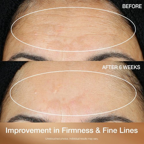 StriVectin Multi-Action Super C Retinol Serum - Brightening & Correcting Formula 1 oz