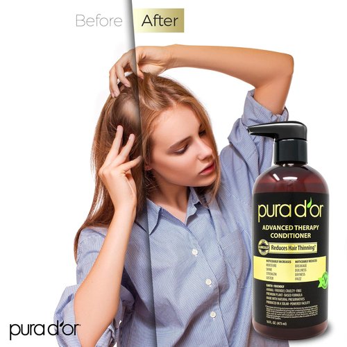 PURA D'OR Advanced Therapy Conditioner - Moisture & Strength for All Hair Types | 16oz, Sulfate-Free, Argan Oil & Biotin