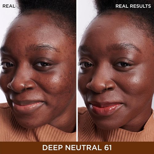IT Cosmetics Bye Bye Dark Spots Concealer | Brightening Serum with 2% Niacinamide & Hyaluronic Acid - Medium Coverage, Natural Finish - 0.22 fl oz