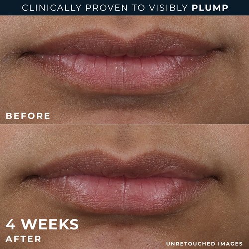 RoC Derm Correxion Lip Volumizer - Lip Plumper Peptide Treatment with Hyaluronic Acid & Vitamin E + Line Smoothing Eye Cream Packette