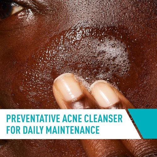 CeraVe Acne Control Cleanser - 2% Salicylic Acid & Niacinamide | Gentle Fragrance-Free Face Wash, 16 Oz