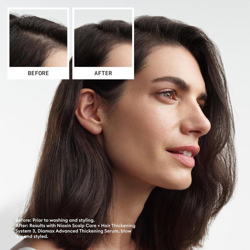 Nioxin System 3 Hair Thickening Conditioner - Nourish Colored & Damaged Hair | Strengthen with Niacinamide & Biotin | 33.8 Fl Oz