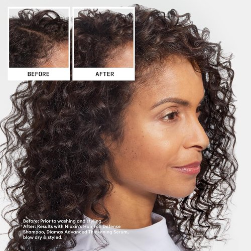 Nioxin Hair Fall Defense Shampoo - Activates Hair Follicles for Less Hair Loss | With Lauric Acid & Caffeine